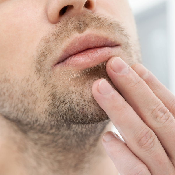 Man scratching irritated skin on chin