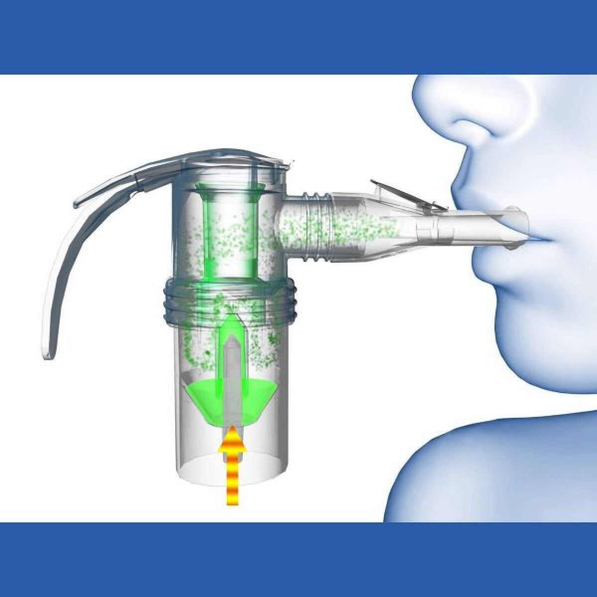 Stock photo of Pari LC Sprint Reusable Nebulizer Cup with Tubing and how it is used